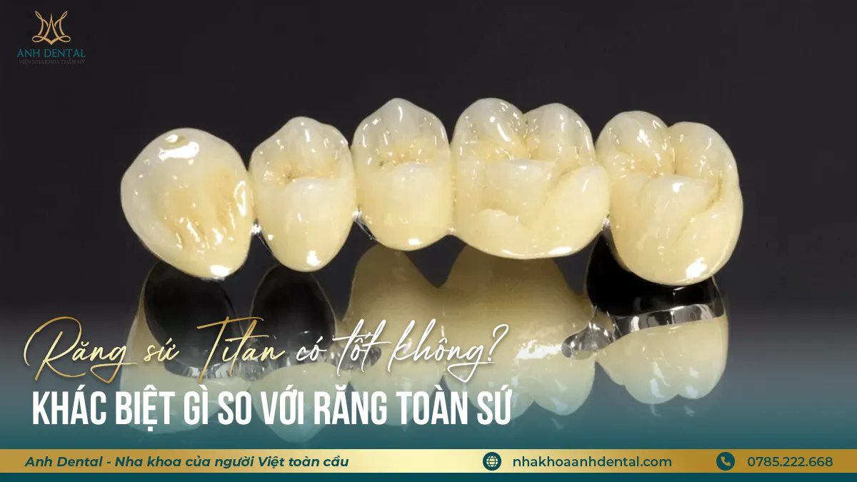 răng sứ titan