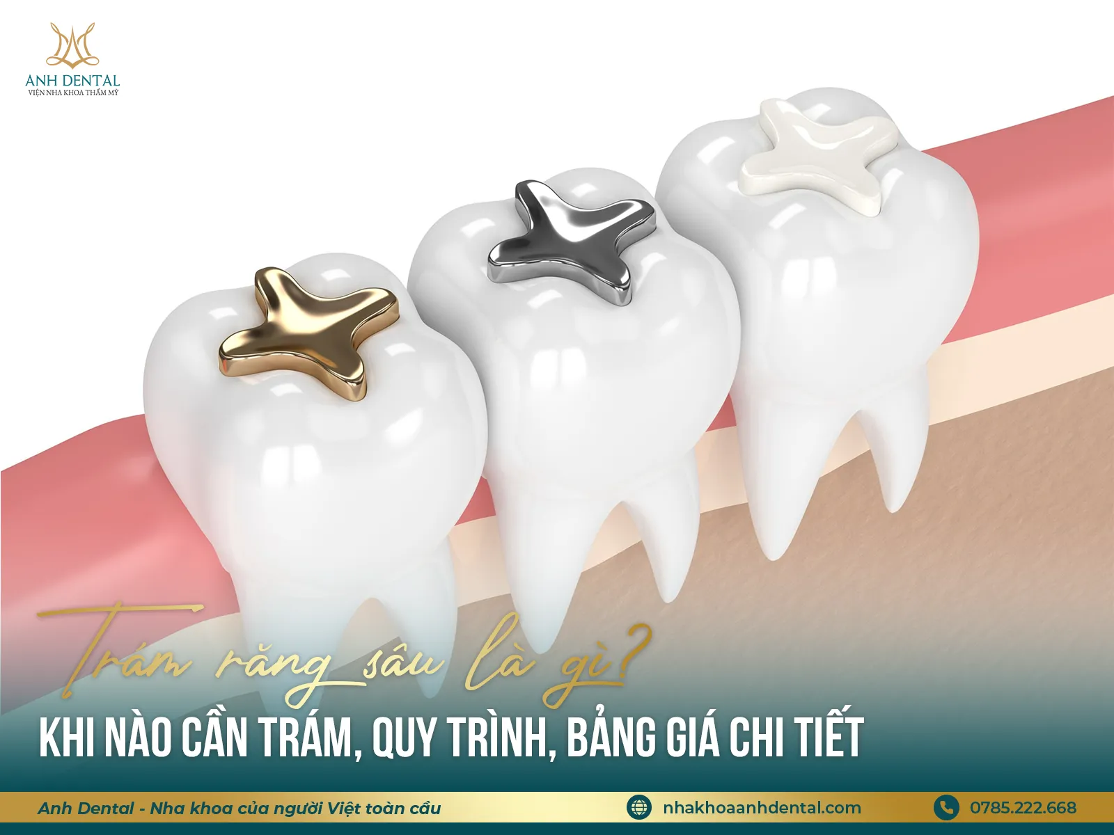 trám răng sâu