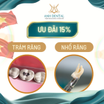 Ưu đãi 15% Trám sứ Inlay Onlay