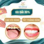 Ưu đãi 15% Trám sứ Inlay Onlay