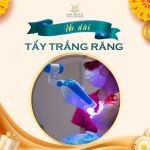 Bảng giá trám răng và tẩy trắng răng tại nha khoa thẩm mỹ Anh Dental 2025