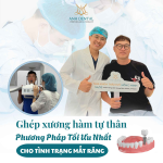 Hiểu đúng về ghép xương tự thân trước khi quyết định cấy ghép implant