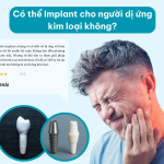 Implant cho người dị ứng kim loại: Có cấy ghép Implant được không?