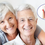 Giải pháp Implant cho người mất răng lâu năm tại Anh Dental
