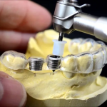 Viện Nha Khoa Thẩm Mỹ Anh Dental - Trung tâm Implant nha khoa không đau an toàn, hiệu quả