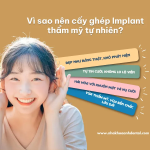 Implant thẩm mỹ tự nhiên - Giải pháp phục hồi răng đẹp như răng thật