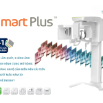 Khám phá máy CT Prod Smart Plus - Giải pháp chẩn đoán hình ảnh nhất