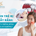 Implant cho người trẻ tuổi: Tại sao và khi nào nên trồng răng Implant?