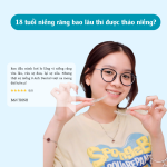 18 tuổi niềng răng bao lâu? Giải pháp toàn diện cho nụ cười rạng rỡ của gen Z