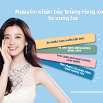 Tẩy trắng răng xong bị vàng lại không? Phải làm sao để khắc phục?