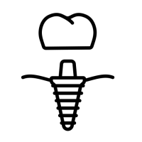 Lắp mão răng