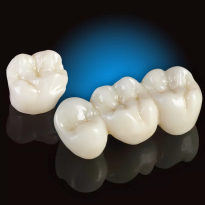 Cầu răng sứ toàn sứ Cercon