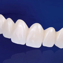 Cầu răng sứ toàn sứ Zirconia
