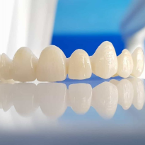 Răng sứ HT Smile cao cấp