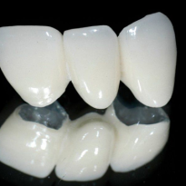 Răng sứ kim loại titan