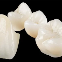 Răng sứ Venus-Zirconia