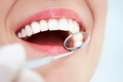 Bọc răng sứ thẩm mỹ