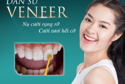 Bảng giá dán sứ Veneer của nha khoa thẩm mỹ Anh Dental 2025