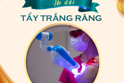 Bảng giá trám răng và tẩy trắng răng tại nha khoa thẩm mỹ Anh Dental 2025