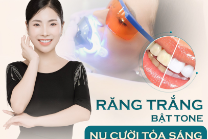 Dịch vụ tẩy trắng răng