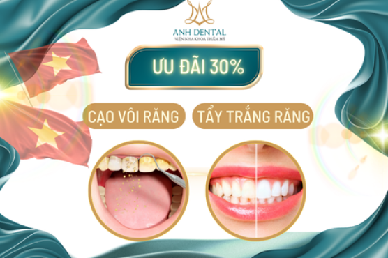 ưu đãi 30% tẩy trắng răng