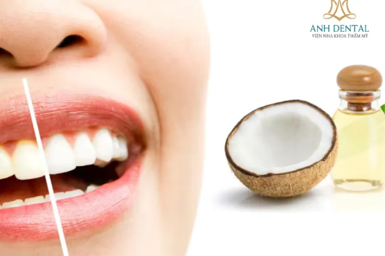 10 cách tẩy trắng răng tại nhà trong 1 ngày hiệu quả, an toàn