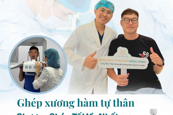Hiểu đúng về ghép xương tự thân trước khi quyết định cấy ghép implant
