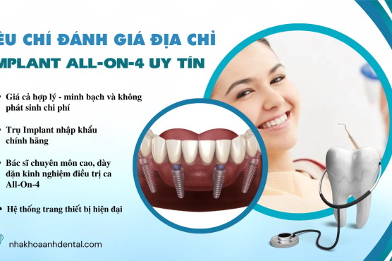 Giải pháp Implant All-On-4 giá rẻ: Giá tốt, hiệu quả và an toàn tại Anh Dental