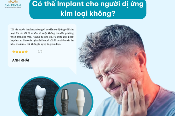 Implant cho người dị ứng kim loại: Có cấy ghép Implant được không?