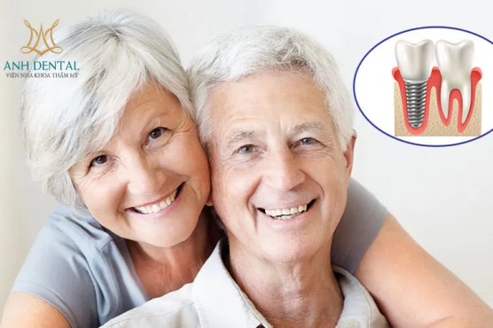Giải pháp Implant cho người mất răng lâu năm tại Anh Dental