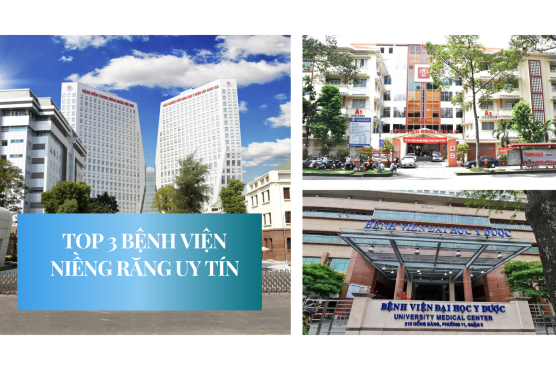 Tổng hợp 3+ bệnh viện niềng răng uy tín: Giá & review thực tế