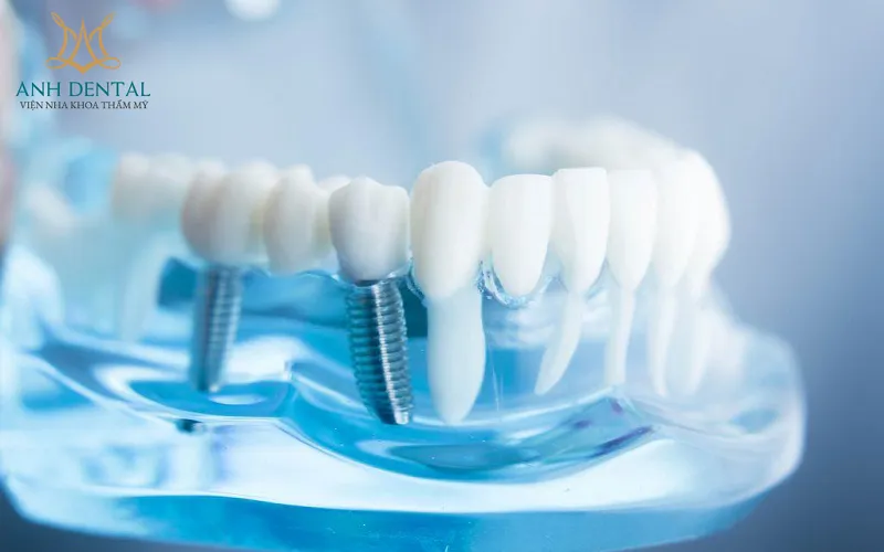 Quy trình kỹ thuật ghép xương tự thân
