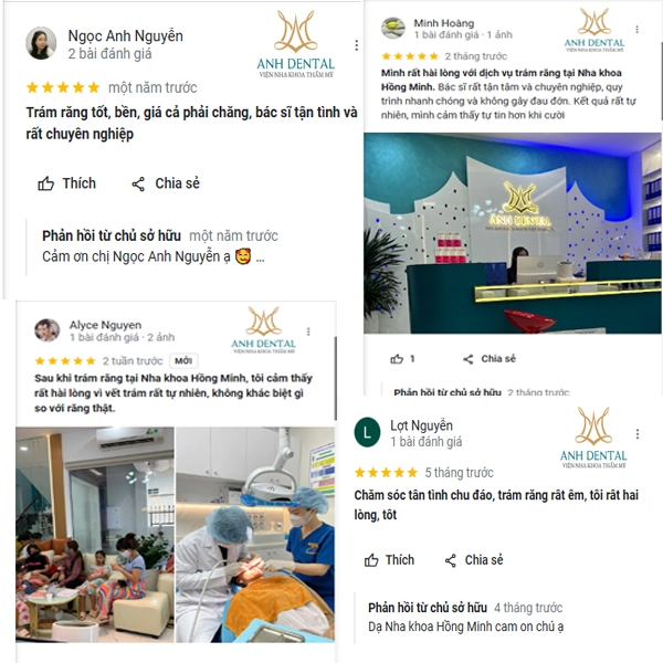 Tác hại của việc trám răng