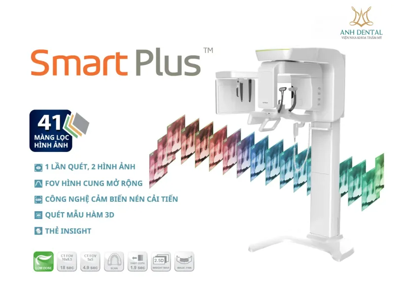 máy CT Prod Smart Plus