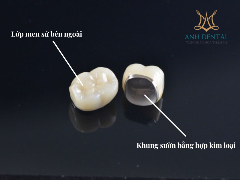 vật liệu làm răng sứ
