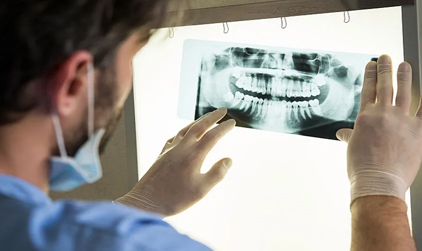 lên kế hoạch điều trị