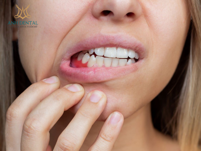 Implant cho người bị nha chu