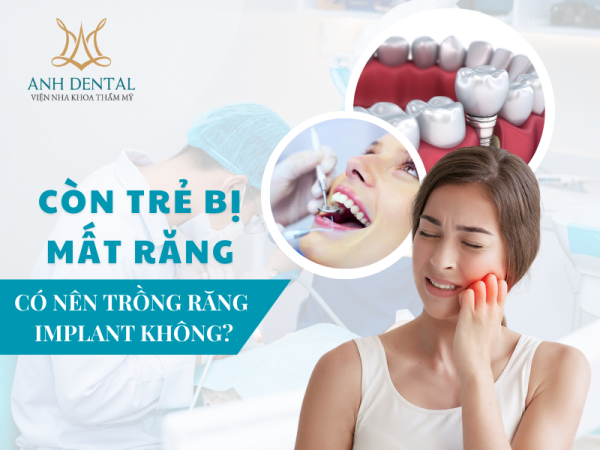 Implant cho người trẻ tuổi