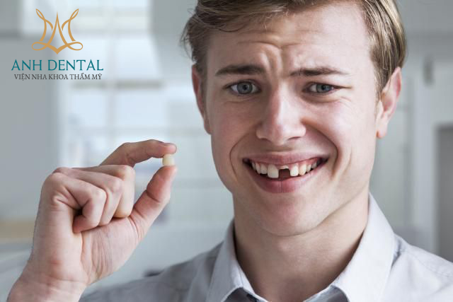 Implant cho người trẻ tuổi