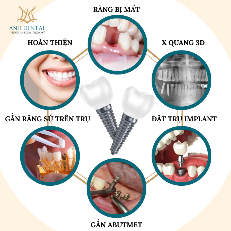 Implant cho người cao tuổi