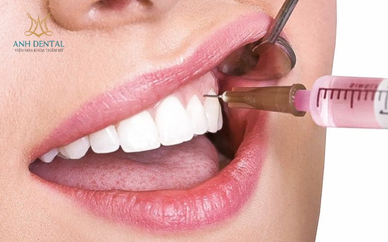 trồng răng sứ có đau không
