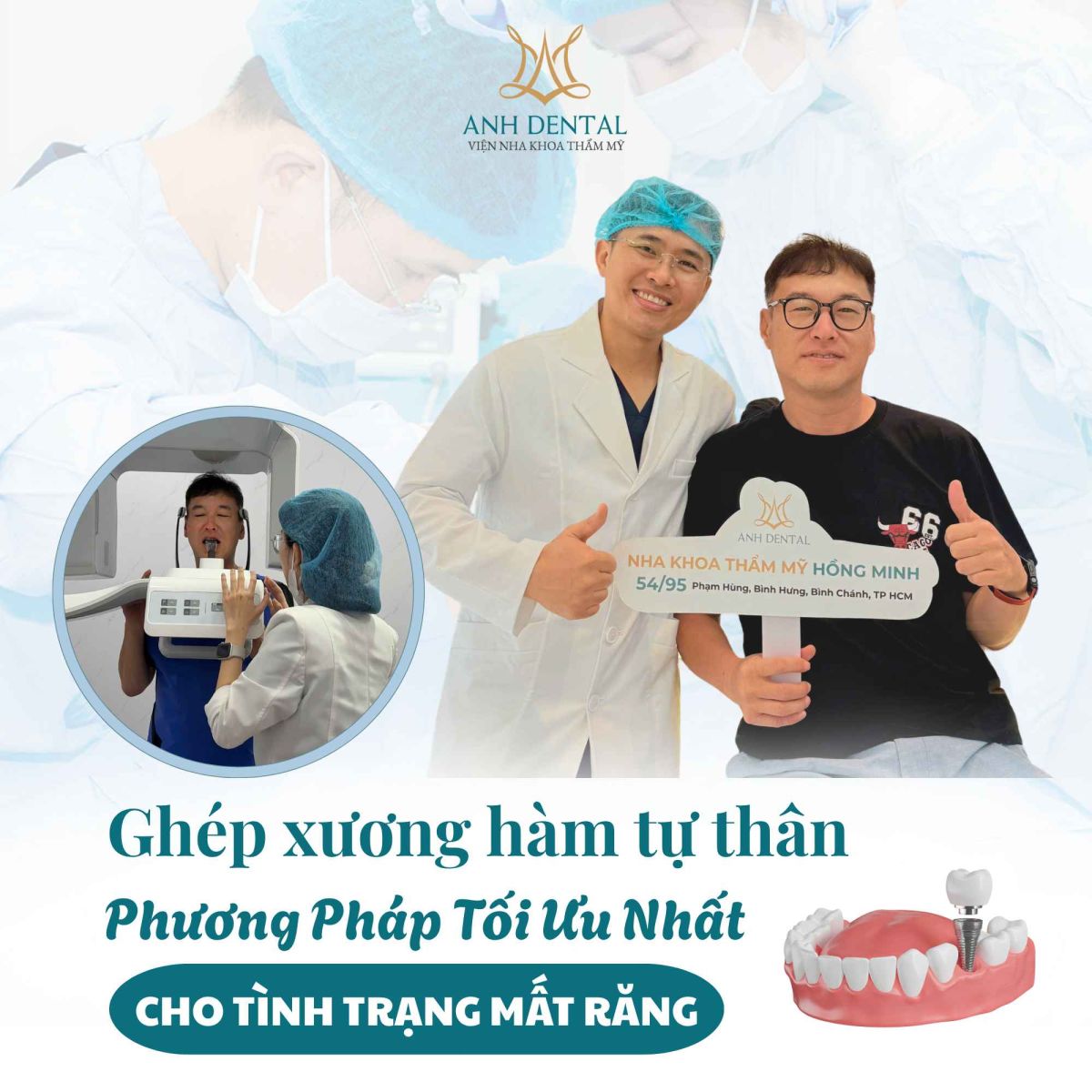 ghép xương hàm tự thân