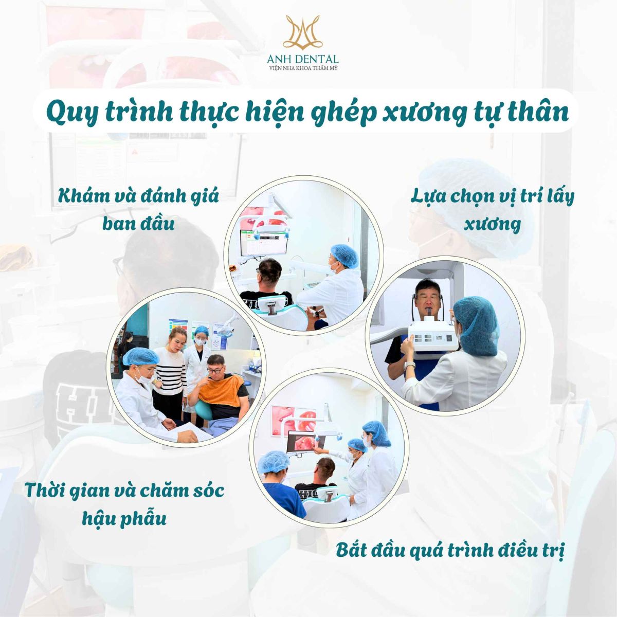 ghép xương tự thân