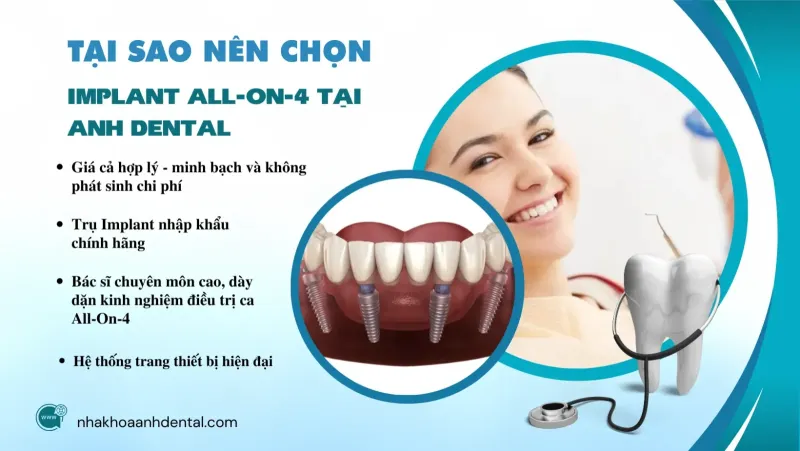 implant all-on-4 giá rẻ