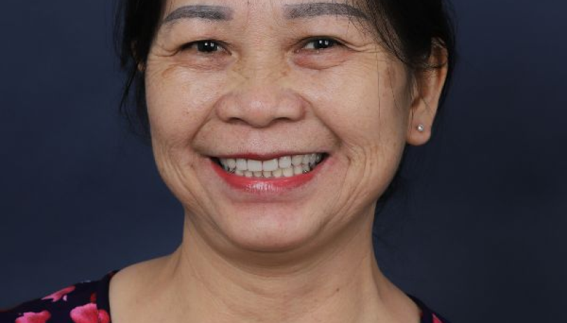 Ảnh sau