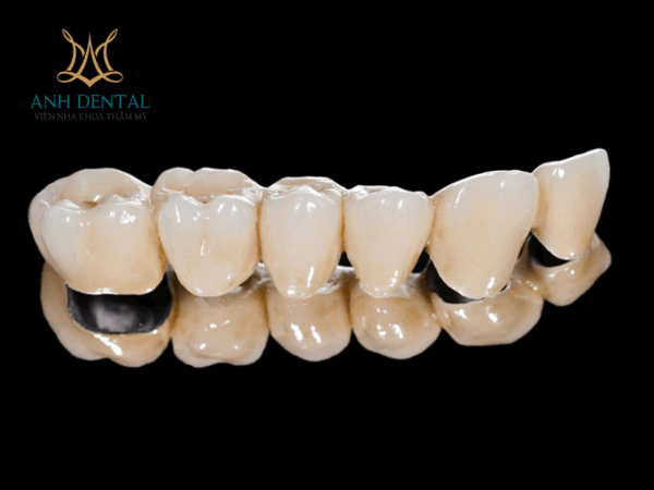 vật liệu làm răng sứ