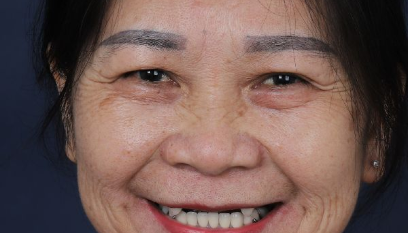 Ảnh trước