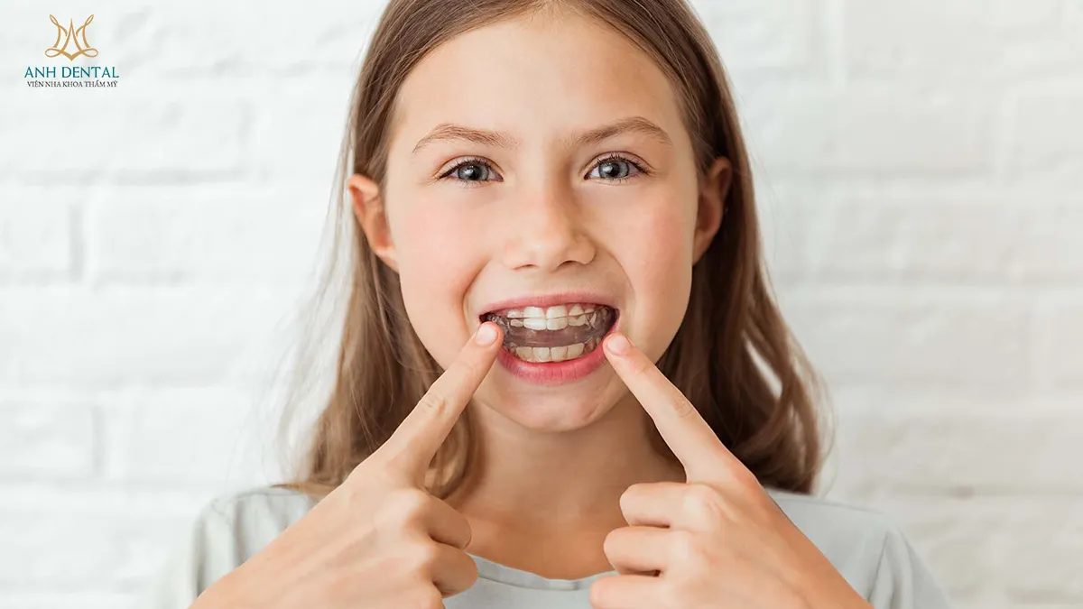 niềng răng bị hóp thái dương