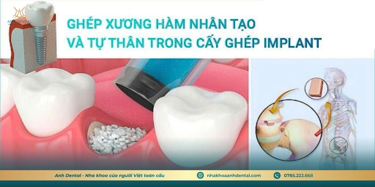 so sanh ghep xuong tu than va ghep xuong nhan tao 2