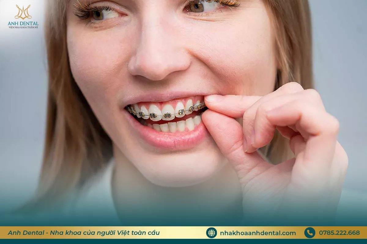 niềng răng bị lung lay